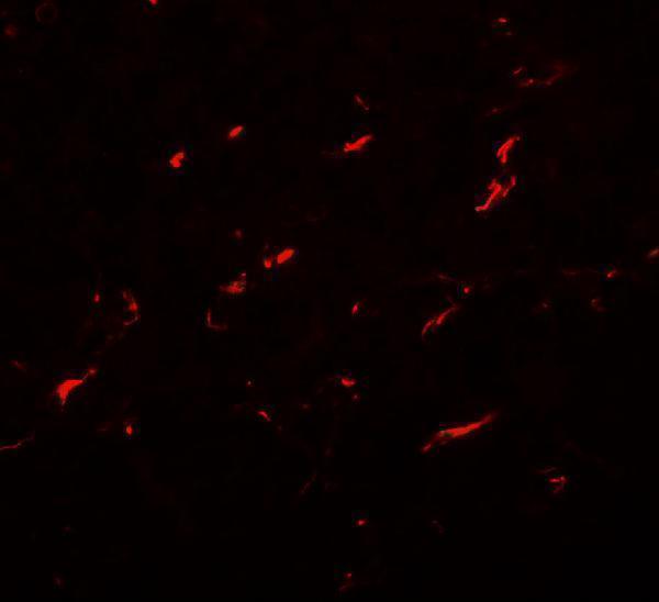 a05377 fmnl1 primary antibodies if testing 2