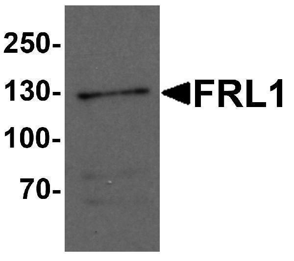 a05377 fmnl1 primary antibodies wb testing 1