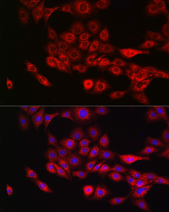 Immunofluorescence analysis of PC-12 cells using Annexin A11  Rabbit pAb  at dilution of 1:50 