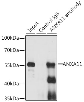 Immunofluorescence analysis of U2OS cells using Annexin A11  Rabbit pAb  at dilution of 1:50 