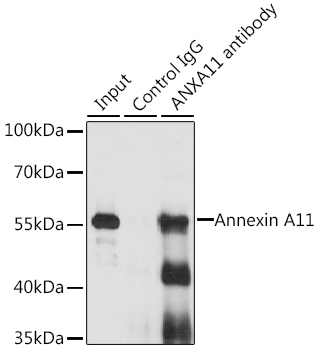 a05379 anxa11 primary antiboties ip testing 4