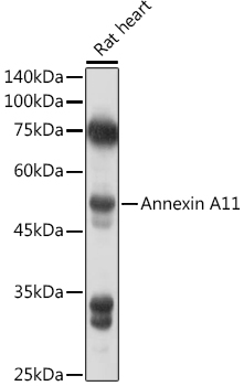 Western blot analysis of extracts of Rat heart cells, using Annexin A11   antibody  at 1:1000 dilution