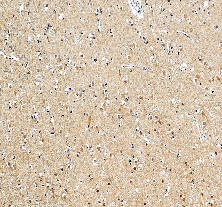 a05380 1 hspbp1 primary antibodies ihc testing 3