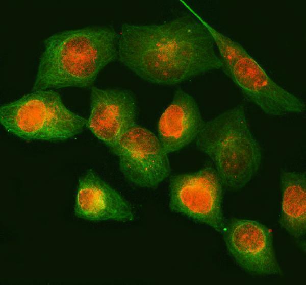  IF analysis of NUP88 using anti-NUP88 antibody (A05382-2) and anti-Beta Tubulin antibody (M01857-3)