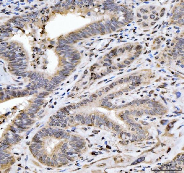 a05384 1 hes5 primary antibodies ihc testing 3
