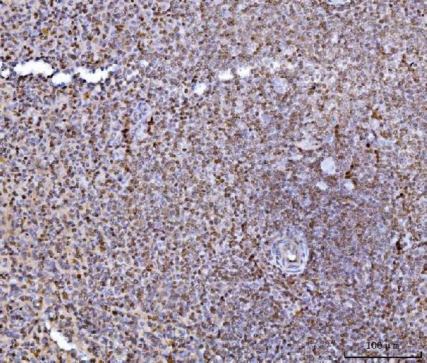 a05384 1 hes5 primary antibodies ihc testing 6