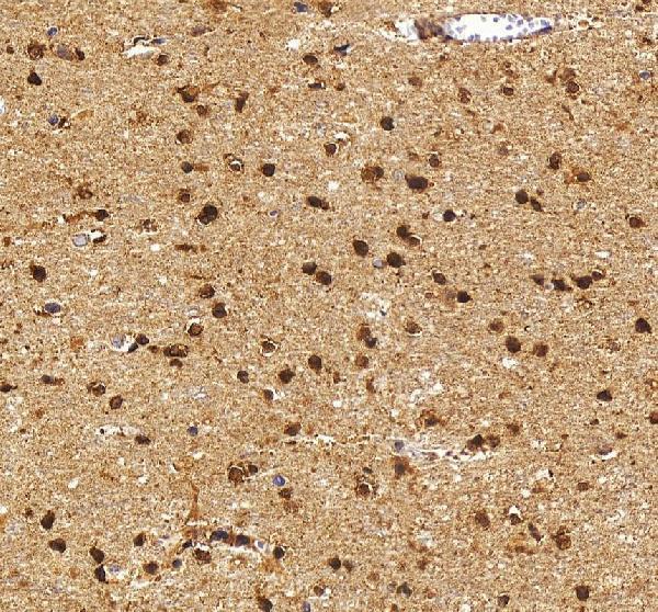 IHC analysis of HES5 using anti-HES5 antibody (A05384-1)