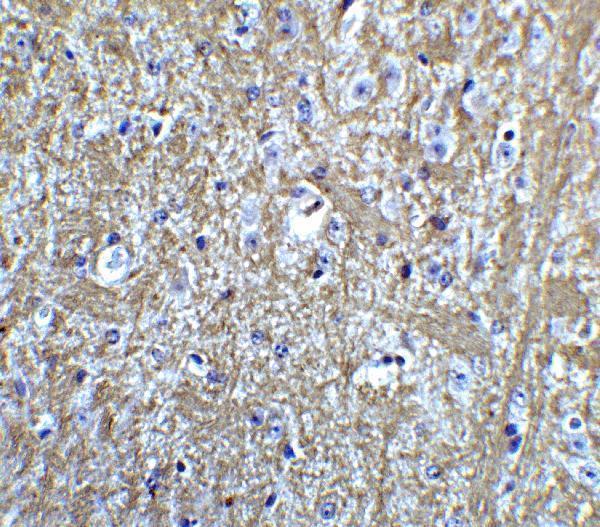 a05384 hes5 primary antibodies ihc testing 4