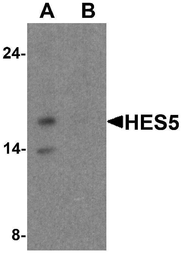 Western blot analysis of HES5 in Raji cell lysate with HES5 antibody at 1 μg/ml (A) the absence and (B) the presence of blocking peptide