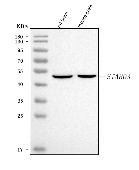  Western blot analysis of MLN64/STARD3 using anti-MLN64/STARD3 antibody (A05385-1)