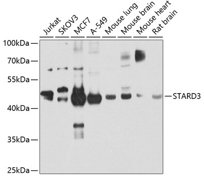 a05385 stard3 primary antiboties wb testing 1