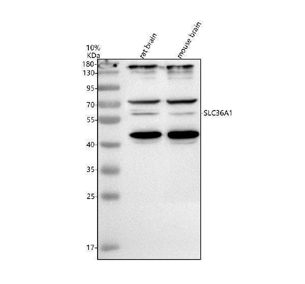 Western blot analysis of SLC36A1 using anti-SLC36A1 antibody (A05386-1)