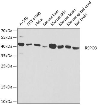a05387 1 rspo3 primary antiboties wb testing 1