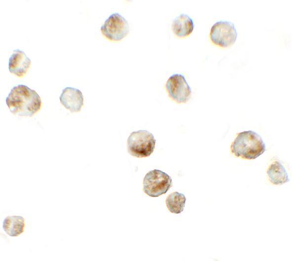 Immunocytochemistry of RSPO3 in 293 cells with RSPO3 antibody at 5 μg/mL