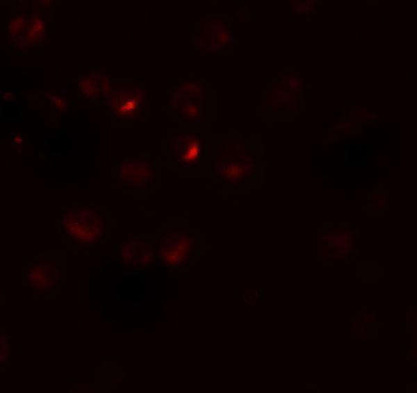 Immunofluorescence of RSPO3 in 293 cells with RSPO3 antibody at 20 μg/mL