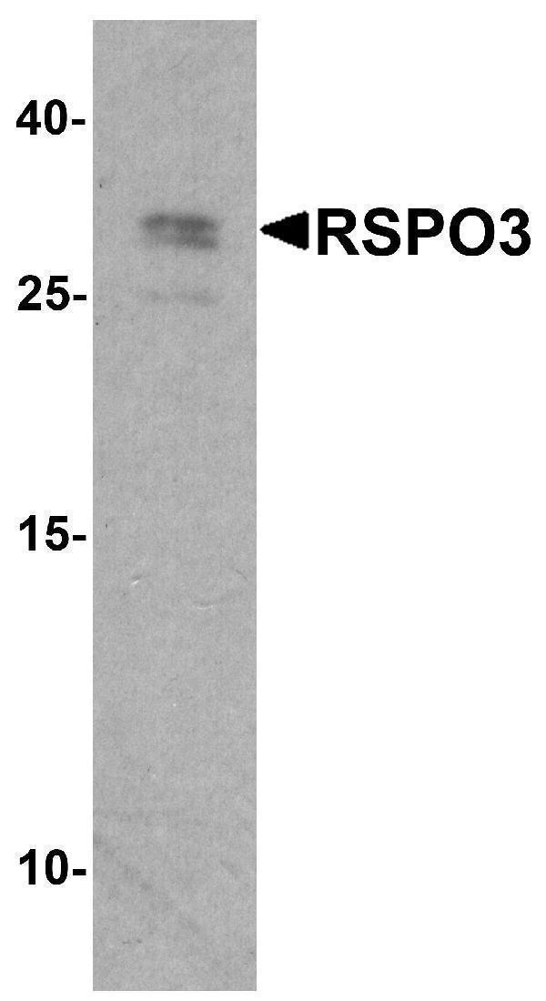 Western blot analysis of RSPO3 in 293 cell lysate with RSPO3 antibody at 1 μg/ml