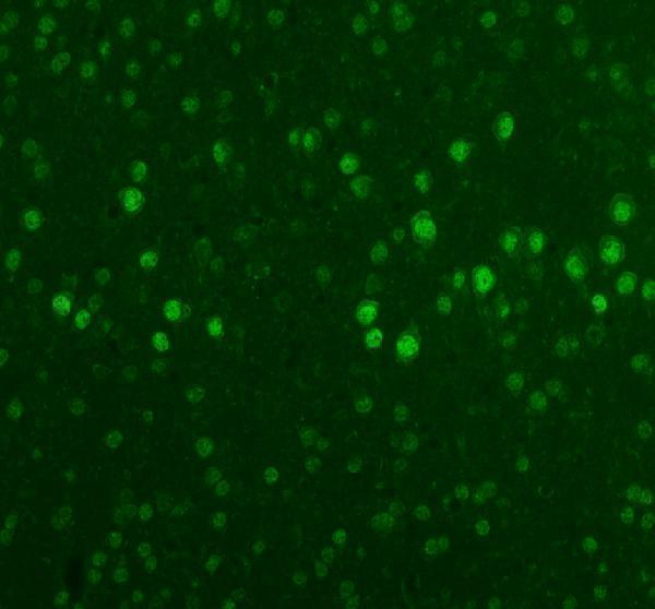 a05389 1 rbfox2 primary antibodies if testing 6