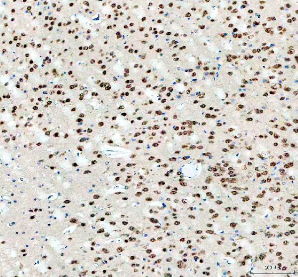 a05389 1 rbfox2 primary antibodies ihc testing 3_1