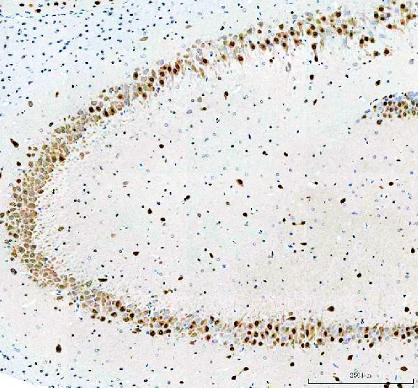 a05389 1 rbfox2 primary antibodies ihc testing 5