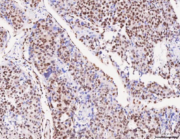  IHC analysis of FOX2/RBM9/RBFOX2 using anti-FOX2/RBM9/RBFOX2 antibody (A05389-2)