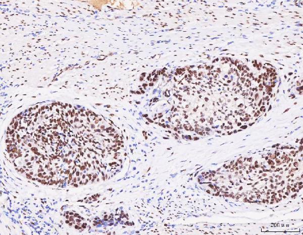  IHC analysis of FOX2/RBM9/RBFOX2 using anti-FOX2/RBM9/RBFOX2 antibody (A05389-2)