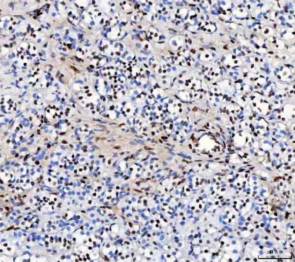 a05389 2 rbfox2 primary antibodies ihc testing 5_1