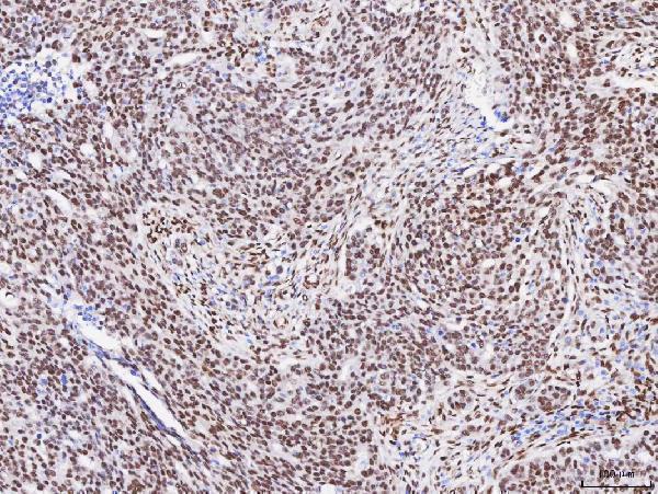 a05389 2 rbfox2 primary antibodies ihc testing 6