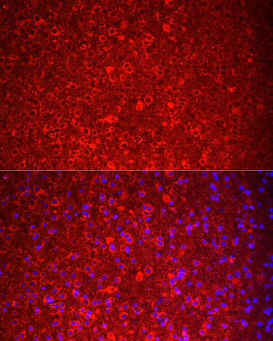 a05391 tac3 primary antiboties if testing 2