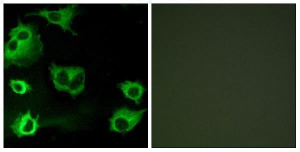 a05393 cysltr1 primary antibodies if testing 1