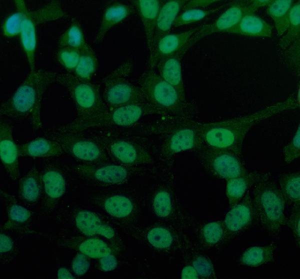 a05396 2 ppp1r8 primary antibodies if testing 1