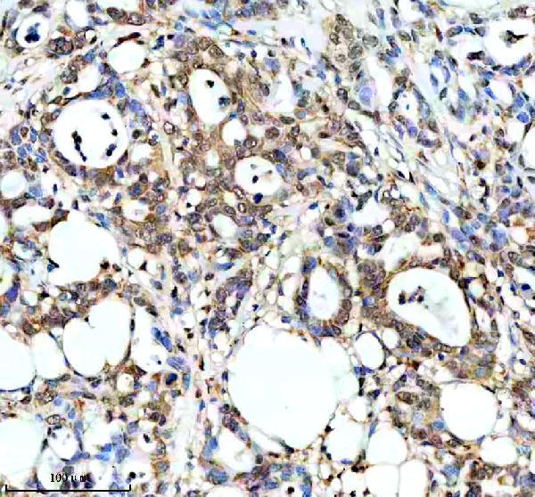 IHC analysis of PPP1R8 using anti-PPP1R8 antibody (A05396-2)