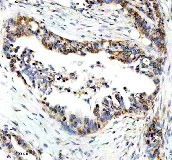 IHC analysis of PPP1R8 using anti-PPP1R8 antibody (A05396-2)