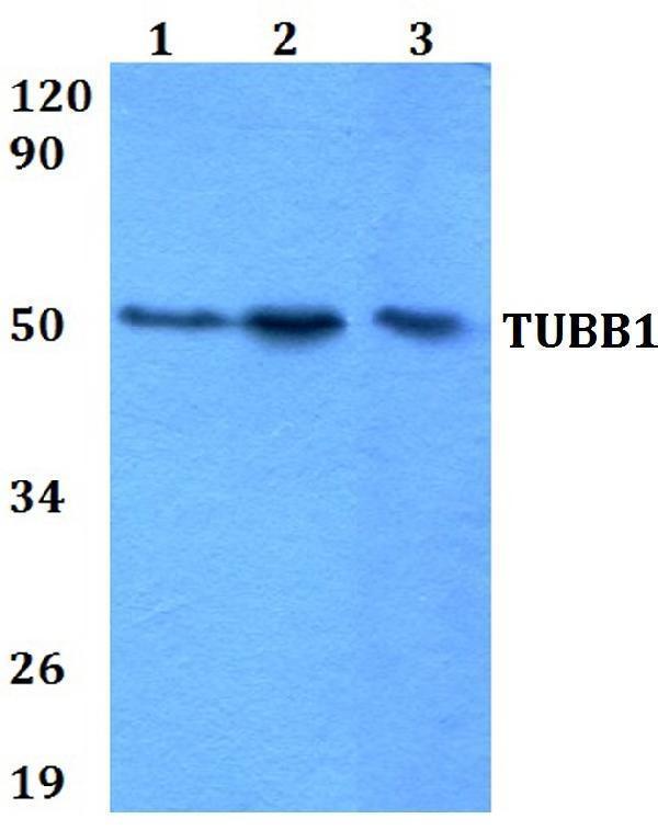 Western blot (WB) analysis of Tubulin Beta-1/2/3/4 polyclonal antibody at 1:500 dilution
Lane1:HEK293Twhole cell lysate
Lane2:Raw264