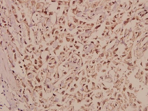 a05399 med17 primary antiboties ihc testing 2