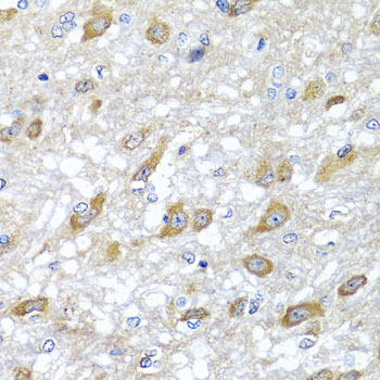 a05402 1 hspa6 primary antiboties ihc testing 2