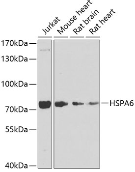 a05402 1 hspa6 primary antiboties wb testing 1