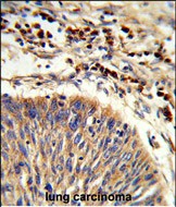 a05402 2 anti hspa6 antibody c term ihc p testing 2