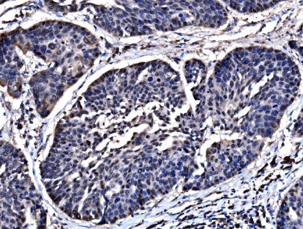  IHC analysis of HSPA6 using anti-HSPA6 antibody (A05402-3)