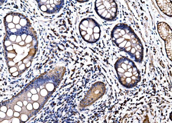  IHC analysis of HSPA6 using anti-HSPA6 antibody (A05402-3)