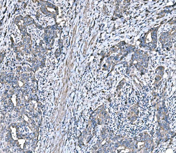 a05402 3 hspa6 primary antibodies ihc testing 4