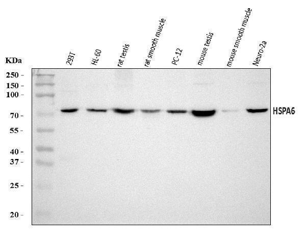  Western blot analysis of HSPA6 using anti-HSPA6 antibody (A05402-3)
