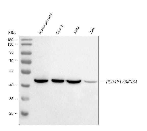 a05403 1 brn3a primary antibodies wb testing 1