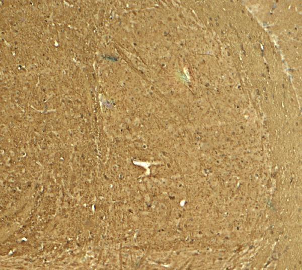 a05405 ptpn5 primary antibodies ihc testing 2