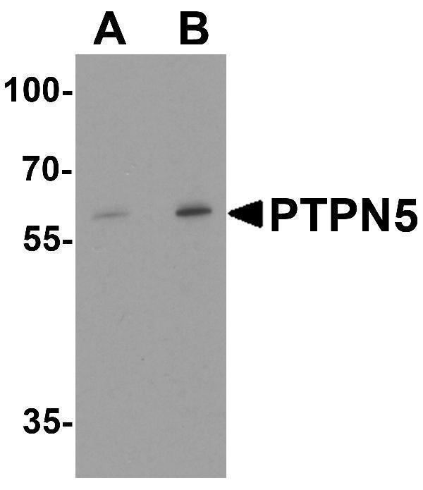 a05405 ptpn5 primary antibodies wb testing 1