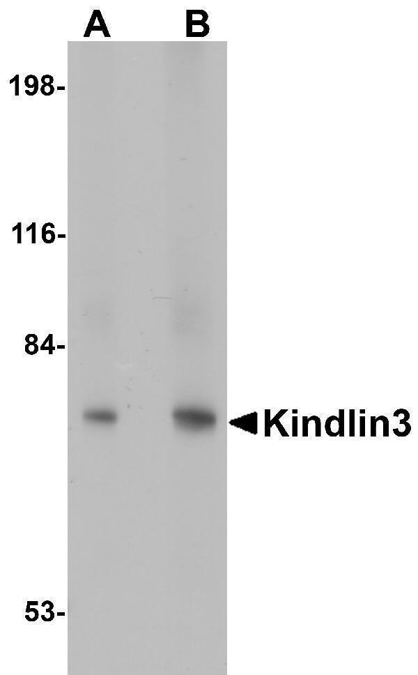a05406 fermt3 primary antibodies wb testing 1