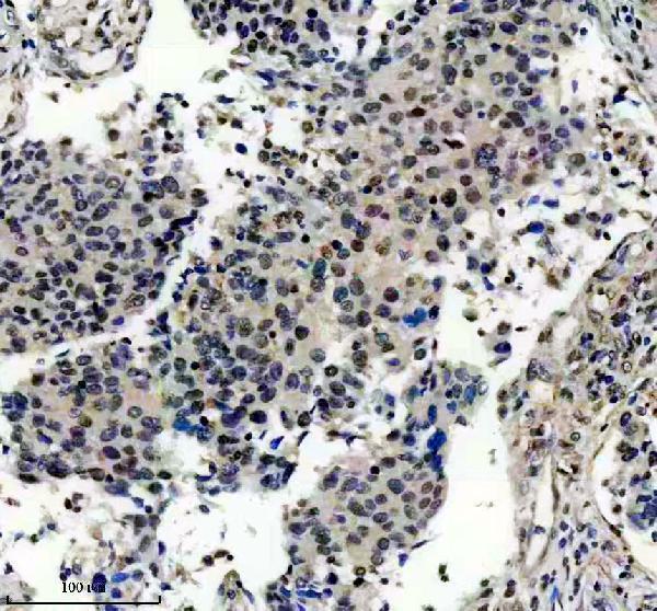 IHC analysis of DDX41 using anti-DDX41 antibody (A05407-2)