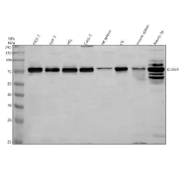 Western blot analysis of DDX41 using anti-DDX41 antibody (A05407-2)