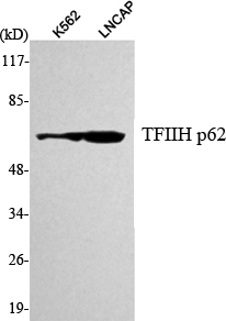 a05408 1 gtf2h1 primary antibodies wb testing 1