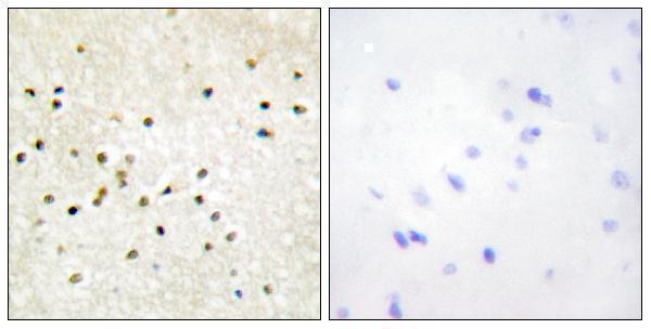 a05408 2 gtf2h1 primary antibodies ihc testing 1