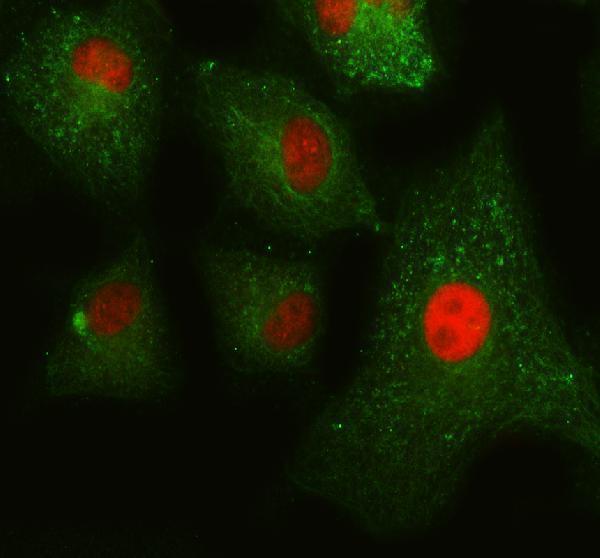 a05408 3 gtf2h1 primary antibodies if testing 1